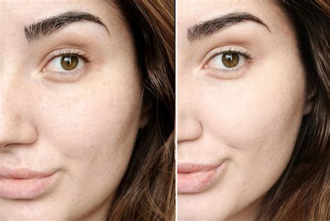 chanel foundation teint ultra|Chanel foundation before and after.